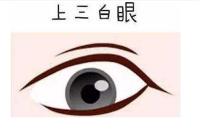 什么是三白眼