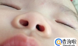 婴儿鼻屎清理方法