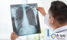 咳嗽会不会引起肺炎 咳嗽本身不会引起肺炎