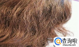 头皮油发尾干是什么发质