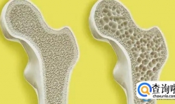 经常喝碳酸饮料的危害