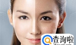 激光祛斑要怎么做？