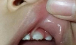 为何宝宝长期用奶瓶会变丑