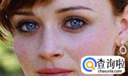 脸上的黑雀子能去掉吗 怎么去除脸上黑雀子