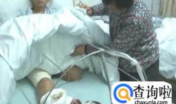 患流感导致截肢的原因