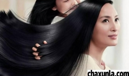 头发总是出油是怎么回事