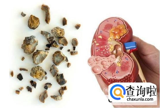 乳钙吃过量会怎么样