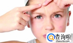 如何和烦人的痘痘说拜拜？