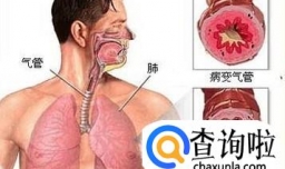 孩子老是咳嗽呕吐怎么回事？