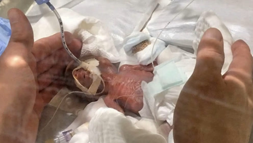 世界上最小的婴儿