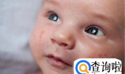 换季期间皮肤过敏怎么办