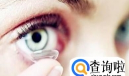 长期戴美瞳有哪些危害