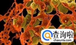 揭秘超级细菌吃掉肺的全过程