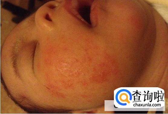 频繁换奶问题多有哪些