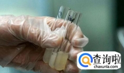 捐精前的准备有哪些