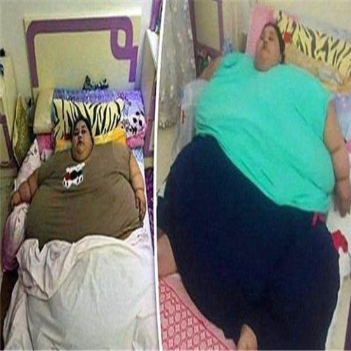 世界最胖的女人