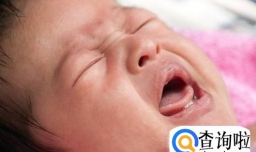 宝宝患有鹅口疮怎么办？鹅口疮是怎么患上的？