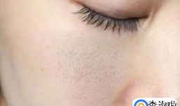 睡觉和护肤哪个对皮肤的影响更大