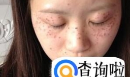 去除斑点对症下药才是上上之策