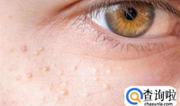 脂肪粒是什么样子