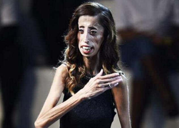 世界上最瘦的人