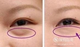 如何使眼睛自然变大有神？