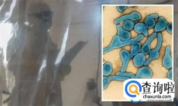 非洲致命疾病：出现症状24小时内死亡 如何预防传染？