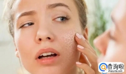 手上有静电是什么原因造成的怎么治疗