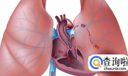 肺栓塞是什么病