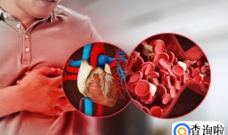 晚上睡不着是不是抑郁了