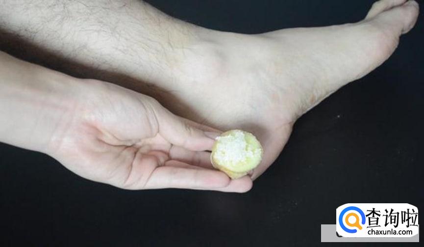 脚后跟干裂脱皮怎么办
